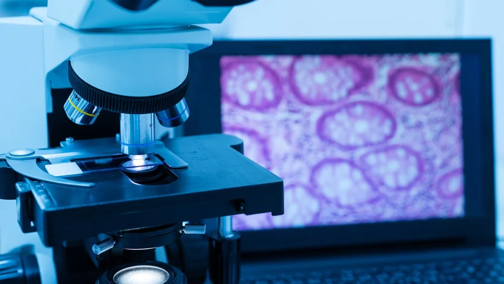 Namibia adopts digital tools for pathology testing